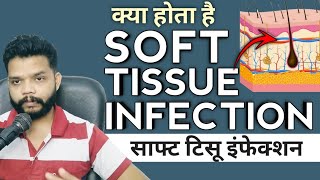 Soft Tissue Infection Kya Hota Hai  Bacterial Infection In Hindi [upl. by Moorish]