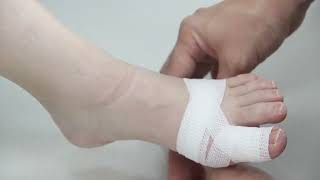 Toe Bandaging Principles and Tips [upl. by Yared]