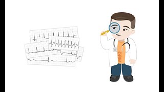 Making sense of common Holter ECG findings [upl. by Airetnuhs497]