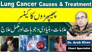 Lungs Cancer CausesSymptoms And Treatment In Urdu [upl. by Eissirc]