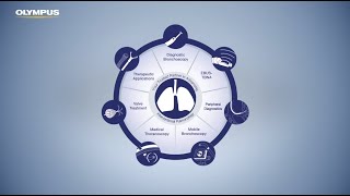 Olympus Solutions for Bronchoscopy [upl. by Baumann]