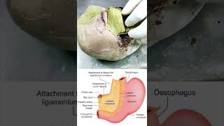 Attachment of lesser omentum on to the liver shorts anatomy biology [upl. by Buyers257]