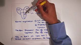 CONSTRICTIVE PERICARDITIS PART 1 [upl. by Siskind]