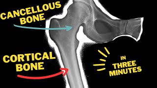 Cortical bone 🦴 Vs Cancellous bone 🦴  In Three minutes [upl. by Fortunia]