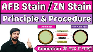 🔴AFB Stain🟣 ZN stain  Tb Stain  Principle amp Procedure  Microbiology in Hindi [upl. by Noyart]