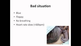 Paediatrics  neonatal resuscitation [upl. by Llirrem976]