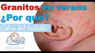 👶🏻 GRANITOS ¿POR QUÉ  Cólico del lactante  Rafael Carvajal [upl. by Aromas352]