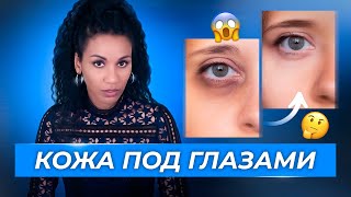 Как убрать тёмные круги и отёки под глазами  Эффект панды🐼 простой рецепт для осветления кожи [upl. by Aticilef]