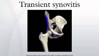 Transient synovitis [upl. by Latini]