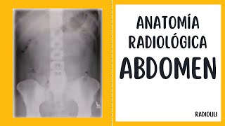 Anatomía Radiológica  Radiología Convencional Abdomen [upl. by Eelynnhoj872]