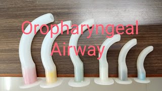 Oropharyngeal Airway Insertion [upl. by Leahcym]