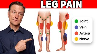 The 11 Causes of Leg Pain Revealed [upl. by Leirbaj654]