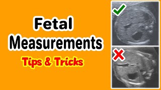 Fetal Measurements Tips and Tricks [upl. by Harrison]