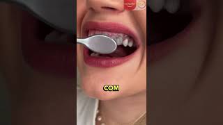 Aprenda a escovar os dentes da forma correta [upl. by Aletta]