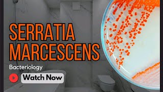 Serratia marcescens Characteristics Diseases Pathogenicity amp Clinical Implications  Bacteriology [upl. by Nayrbo]