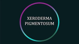 What is Xeroderma Pigmentosum XP [upl. by Takakura]