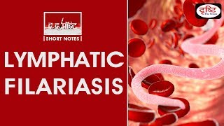 LYMPHATIC FILARIASIS  To The Point [upl. by Airtemed229]