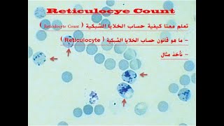 Reticulocyte Count [upl. by Lin]