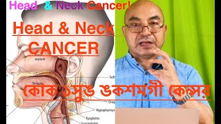 Head amp Neck Cancer  কোক ১সুঙ ঙকশমগী কেন্সর Prevention amp Early Treatment [upl. by Ert]