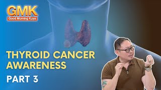 Thyroid Cancer Awareness Part 33  Usapang Pangkalusugan [upl. by Adamski]