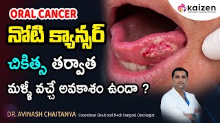 Can mouth cancer be cured completely  DrAvinash Chaitanya  Kaizen Hematology Oncology Network [upl. by Niamjneb867]