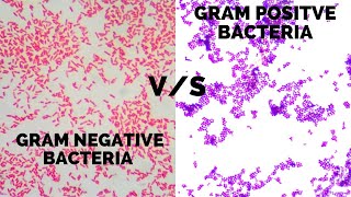 Gram Positive vs Gram Negative Bacteria [upl. by Eidassac228]