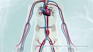 CIRURGIA ENDOVASCULAR DE ANEURISMA DA AORTA ABDOMINAL [upl. by Aekin]