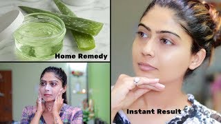 How To Do Aloe Vera Facial For Clear Glowing And spotless Skin  Rinkal Soni [upl. by Adekam]