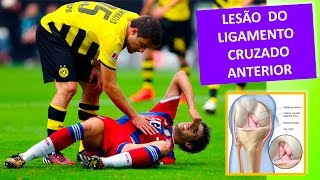 LESÃO DO LIGAMENTO CRUZADO ANTERIOR DO JOELHO [upl. by Pepper]