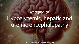 Imaging of ToxicMetabolic Brain Disorders hypoglycemic hepatic amp uremic encephalopathy [upl. by Mellie]