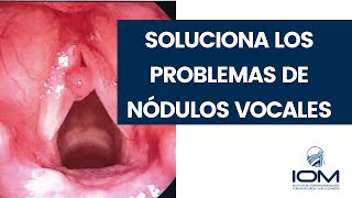 🗣️ 𝑵ó𝒅𝒖𝒍𝒐𝒔 𝑽𝒐𝒄𝒂𝒍𝒆𝒔 descubre por qué se producen y cómo podemos ❌ ̶e̶l̶i̶m̶i̶n̶a̶r̶l̶o̶s̶ [upl. by Ronnie]