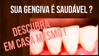 Como saber se a GENGIVA está SAUDÁVEL DESCUBRA EM CASA [upl. by Garvey55]