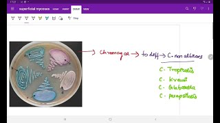 Oppurtunistic Mycoses  Microbiology  Image based discussion [upl. by Ynez]