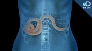 Why Parasites May Not Be All That Bad [upl. by Au]