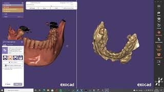 Transfer an EXOPLAN implant plan to EXOCAD and 3D Print Crown in 10 mins  IDDA MiniBytes Tutorials [upl. by Oisorbma589]