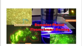 Auramine Stain and Flourescence Microscopy for Tuberculosis [upl. by Gerfen]