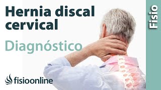 Cómo saber si tienes una hernia discal cervical [upl. by Aala]