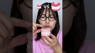 Big Teeth vs Small Teeth Eating Challange 🤣shortsviraltrendingshortshumanitychallenge [upl. by Rednasela]