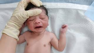 Forceps delivery of newborn baby after birth with first cry looks adorable when dressed up [upl. by Adyam913]