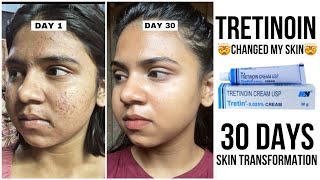 30 days skin tansformation with tretinoin  How to use tretinoin without side effectspurging [upl. by Fleisher]