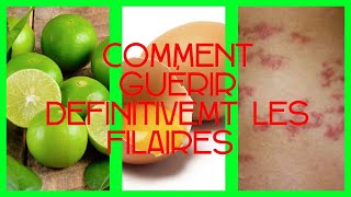 COMMENT GUÉRIR DEFINITIVEMENT LES FILAIRES HOW TO TREAT WIRES NATURALLY [upl. by Arocal]