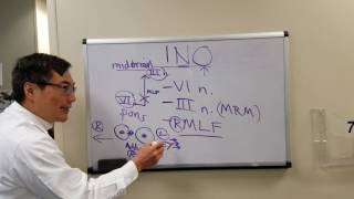 Internuclear Ophthalmoplegia INO [upl. by Colfin]