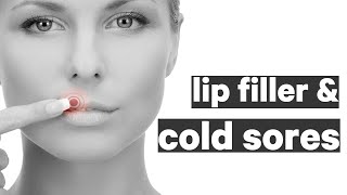 Can you get lip filler with a cold sore  QampA  The gift of healthy skin  Episode twentytwo [upl. by Carli]