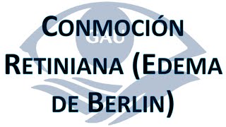 Conmoción Retiniana Edema de Berlin 04 Mayo 2022 [upl. by Pen]