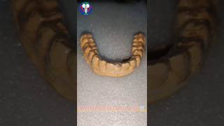 Ortho Retainer  Mandible Treatment  Hard Invisible Appliance  Tamil Dental Lab  viralvideo art [upl. by Manda]