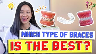 Types of Braces COMPARED amp EXPLAINED  BraceYourself🦷 [upl. by Torray320]