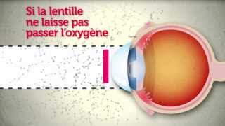 Lentilles de contact  attention les yeux [upl. by Ahsenak180]