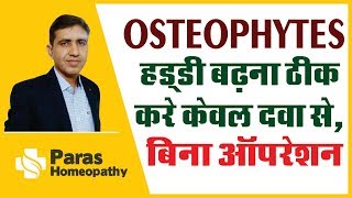 Osteophytes  हड्डी बढ़ने का कारण  Bone Spur  हड्डी बढ़ना ठीक करे केवल दवा से बिना ऑपरेशन इलाज [upl. by Malan]