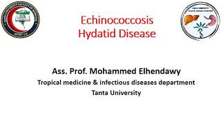 Hydatid disease Tropical Lecture [upl. by Sidras]