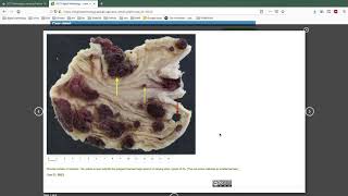 Explore wwwdigitalpathologyuctacza [upl. by Yecats]